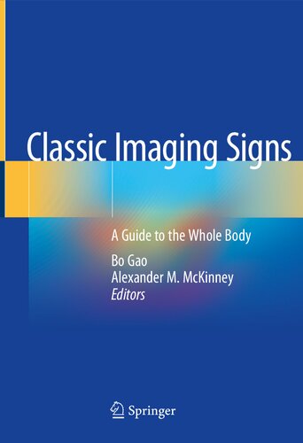Classic Imaging Signs A Guide Tothewhole Body Bo Gao Alexander M Mckinney Ed