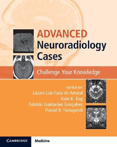 Advanced Neuroradiology Cases Lzaro Lus Faria Do Amaral Asim K Bag