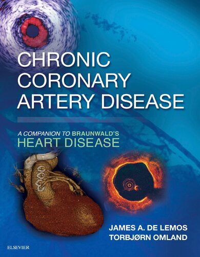 Chronic Coronary Artery Disease A Companion To Braunwalds Heart Disease James A De Lemos