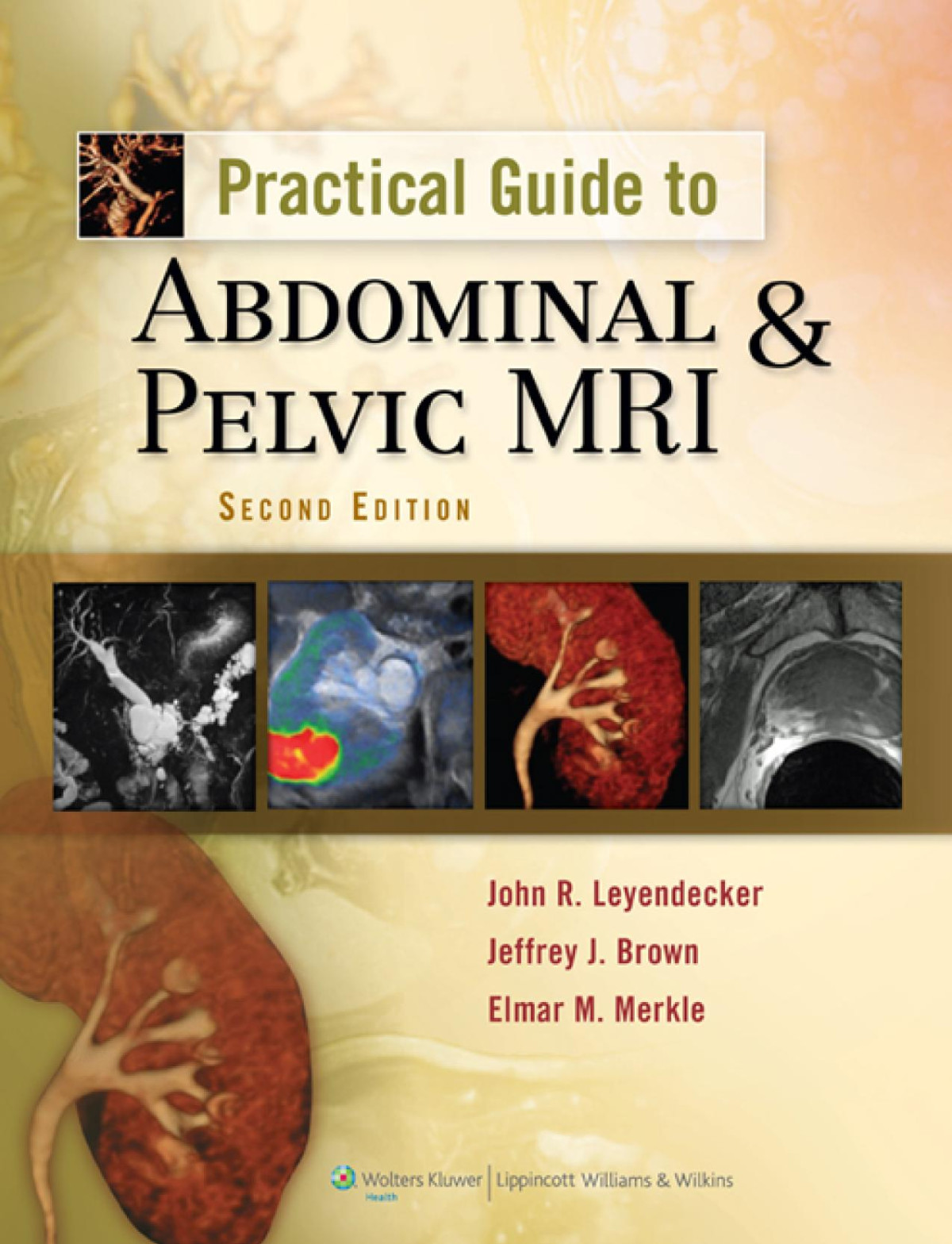 Practical Guide To Abdominal And Pelvic Mri 2nd John R Leyendecker Jeffrey J Brown Elmar M Merkle
