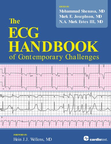 The Ecg Handbook Of Contemporary Challenges 1st Edition Mohammad Shenasa