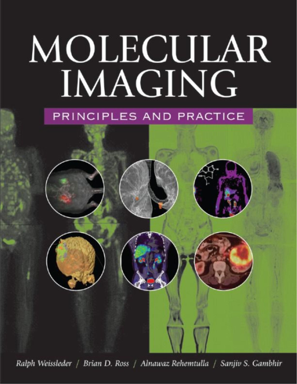 Molecular Imaging Principles And Practice Ralph Weissleder