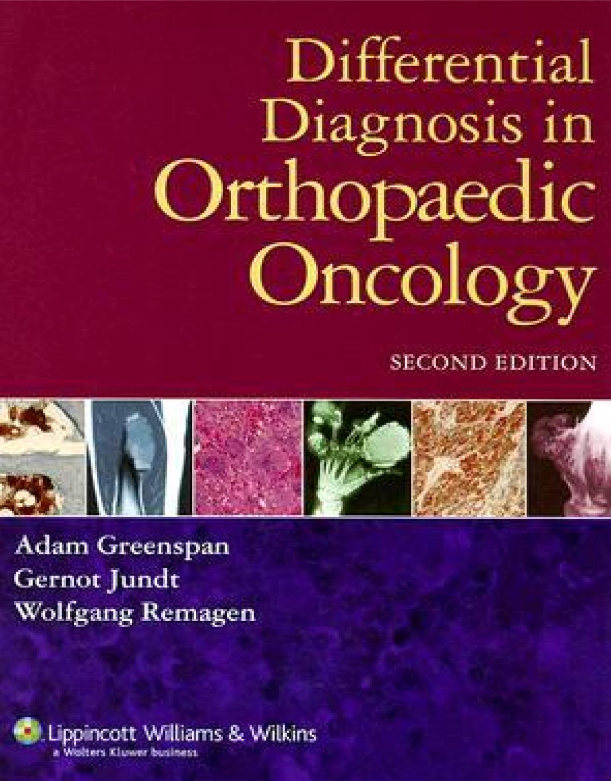 Differential Diagnosis In Orthopaedic Oncology 2nd Edition Adam Greenspan