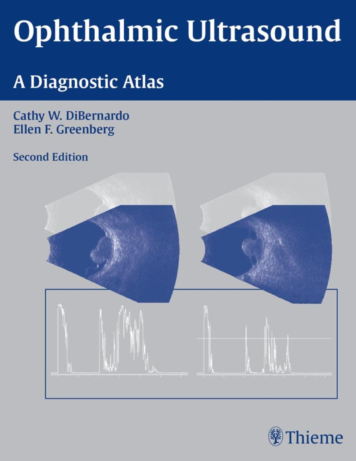 Ophthalmic Ultrasound A Diagnostic Atlas 2nd Edition Cathy W Dibernardo
