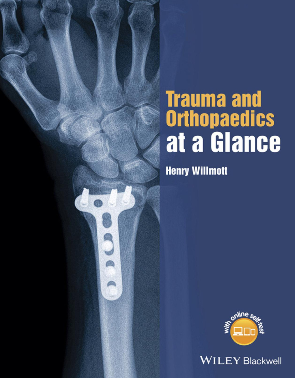 Trauma And Orthopaedics At A Glance Henry Willmott