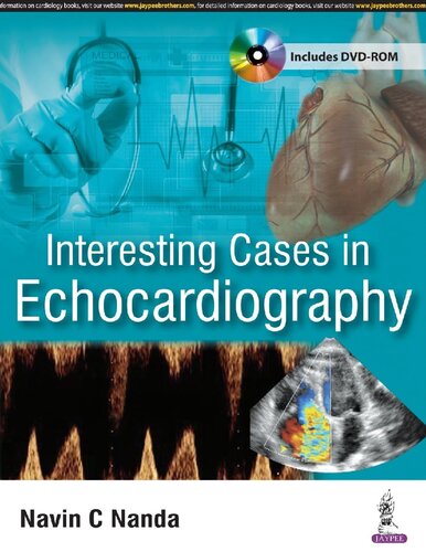 Interesting Cases In Echocardiography Navin C Nanda
