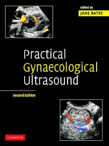 Practical Gynaecological Ultrasound 2nd Edition Jane Bates Ed