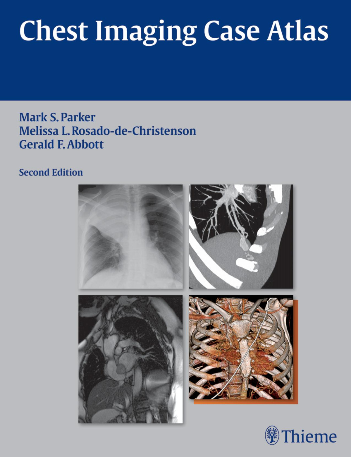 Chest Imaging Case Atlas 2nd Edition Mark S Parker Melissa L Rosadodechristenson