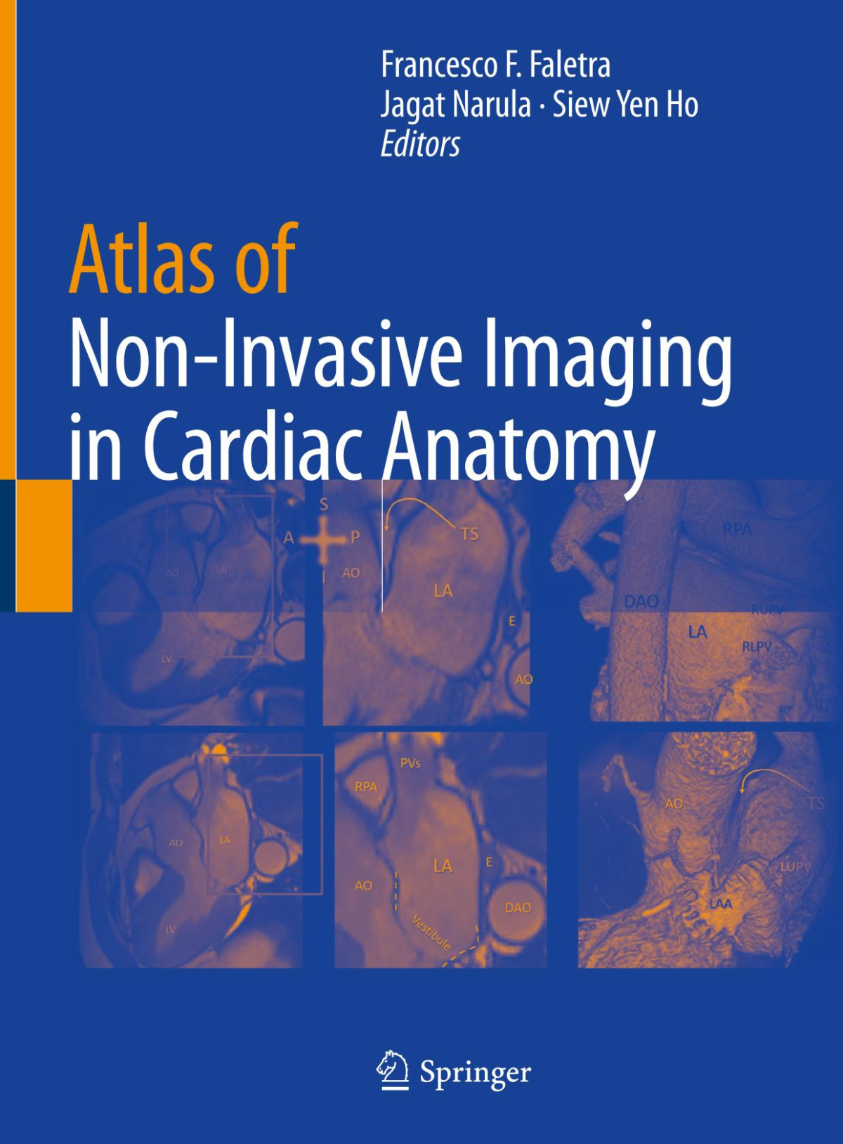 Atlas Of Noninvasive Imaging In Cardiac Anatomy Francesco F Faletra