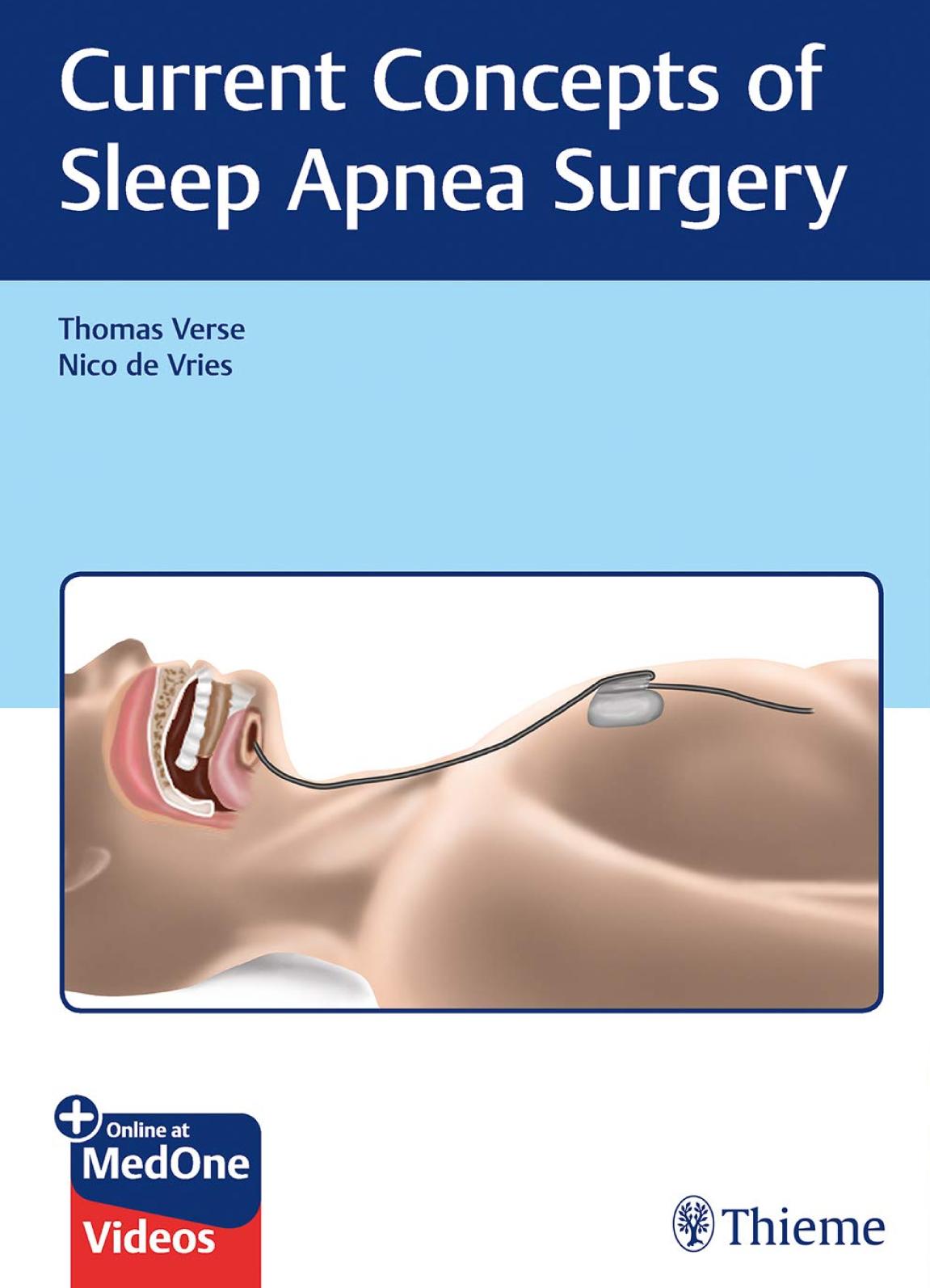 Current Concepts Of Sleep Apnea Surgery Thomas Verse Nico De Vries