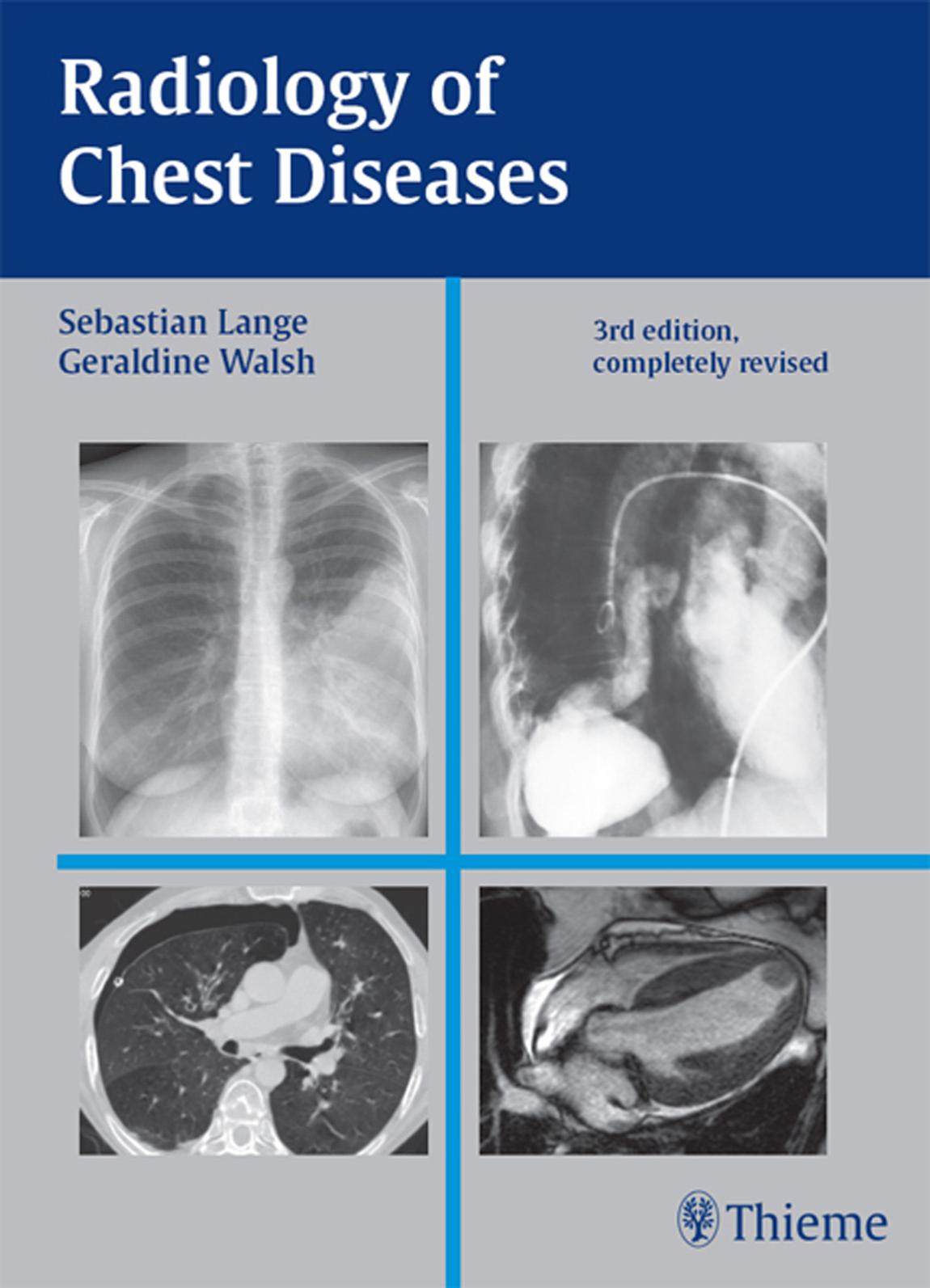 Radiology Of Chest Diseases 3rd Edition Sebastian Lange Geraldine Walsh