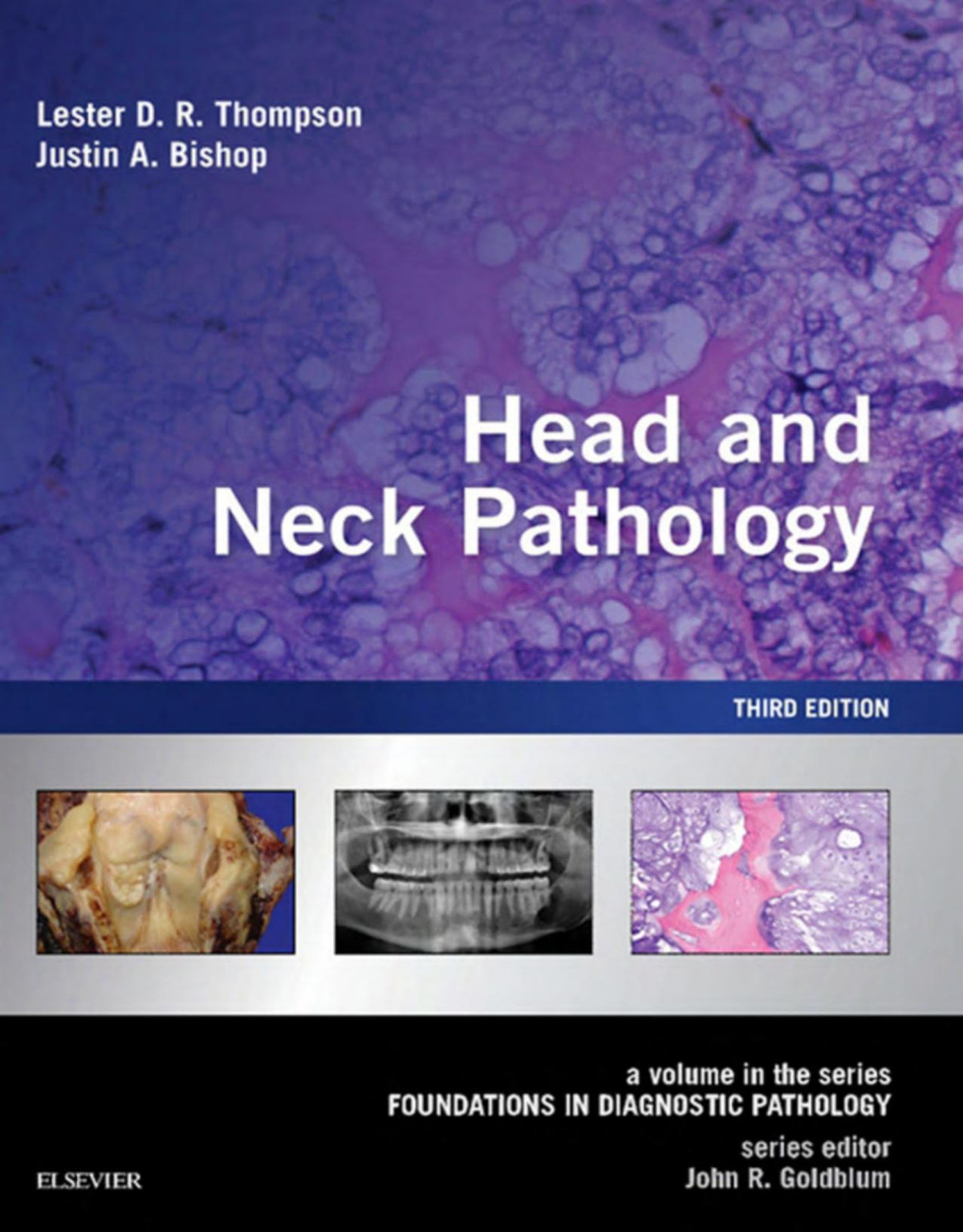 Head And Neck Pathology 3rd Edition Lester Dr Thompson Justin A Bishop