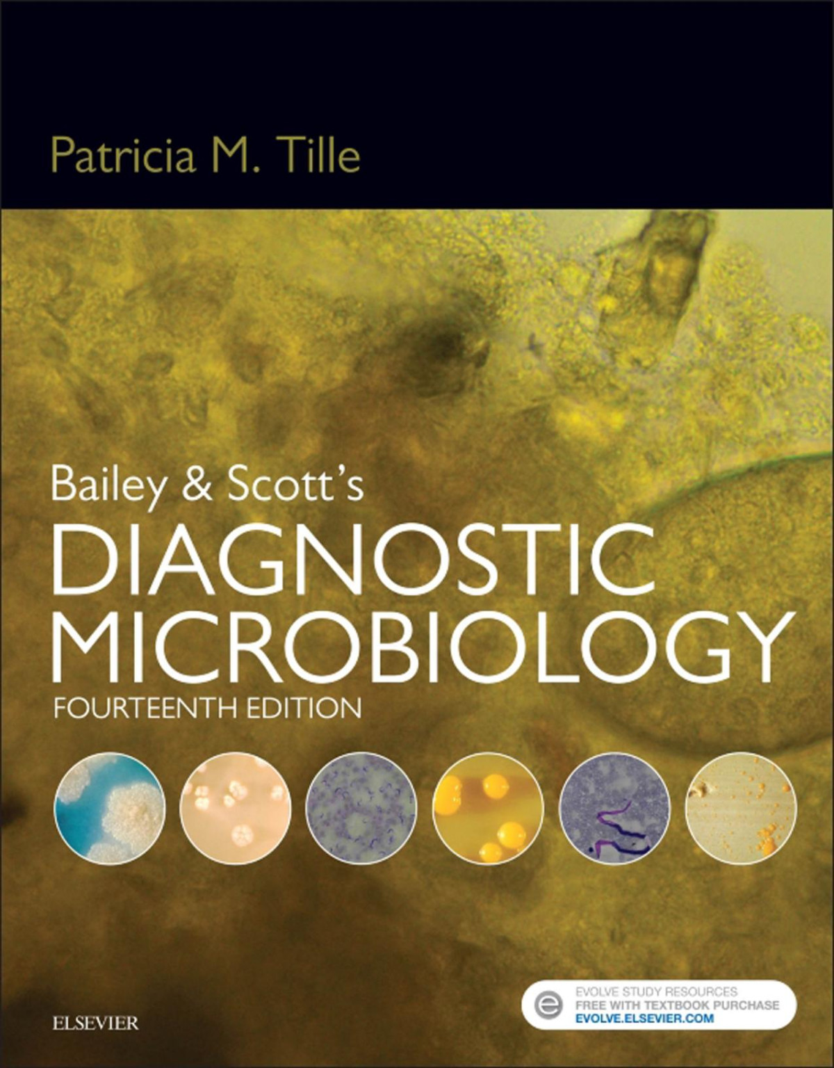 Bailey Scotts Diagnostic Microbiology 14th Edition Patricia M Tille
