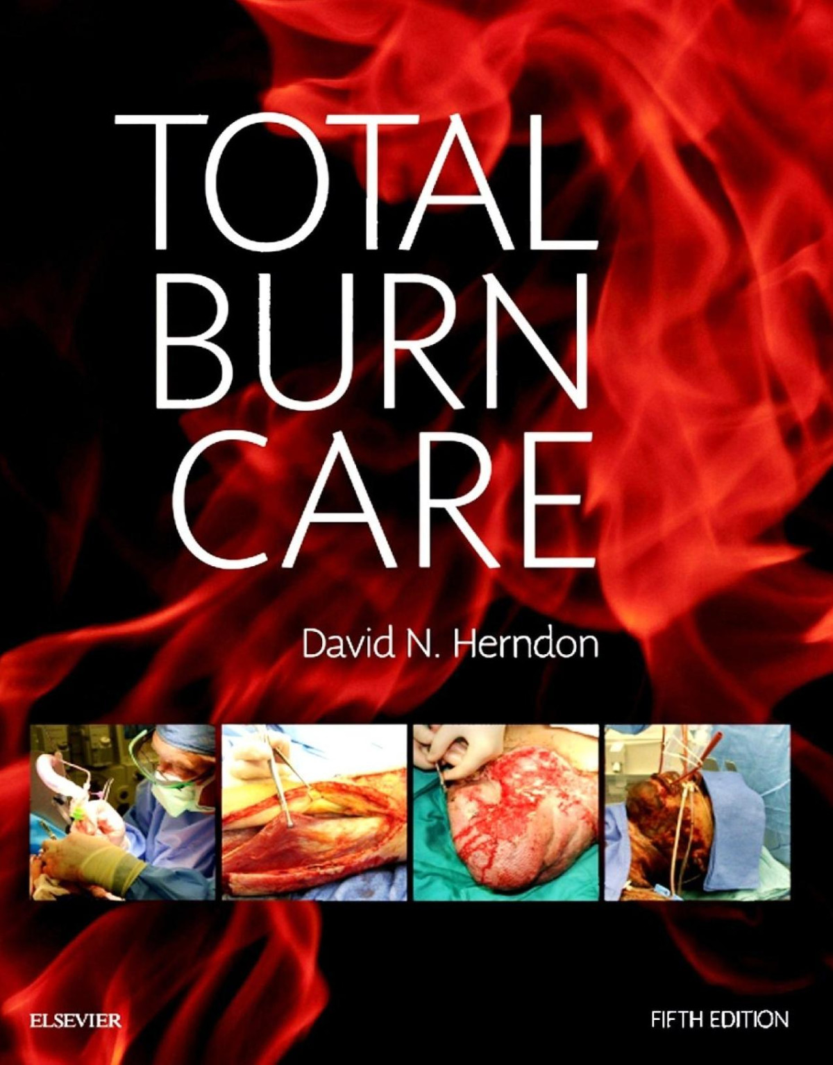 Total Burn Care 5th Edition David N Herndon