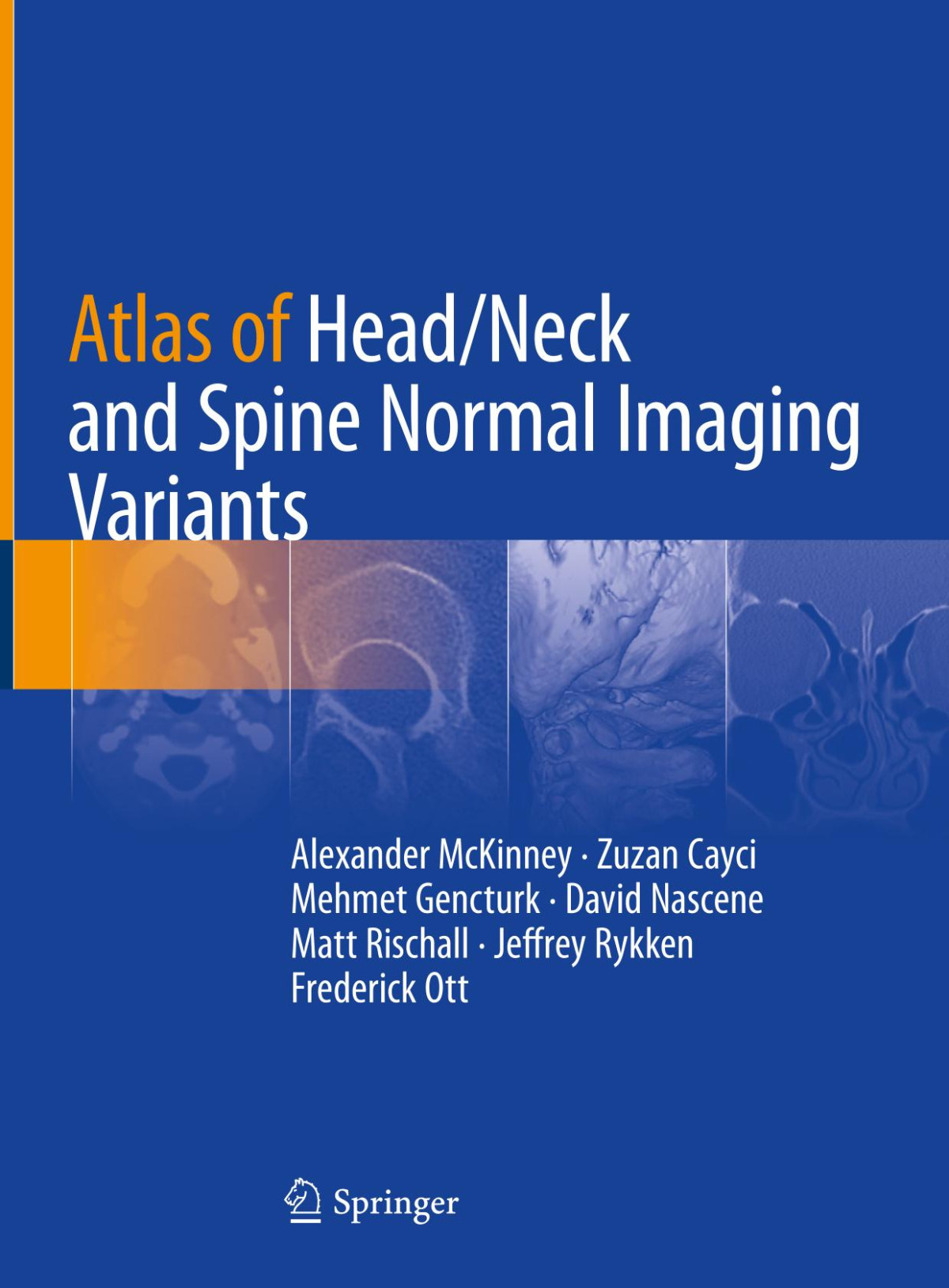 Atlas Of Headneck And Spine Normal Imaging Variants Alexandermckinney