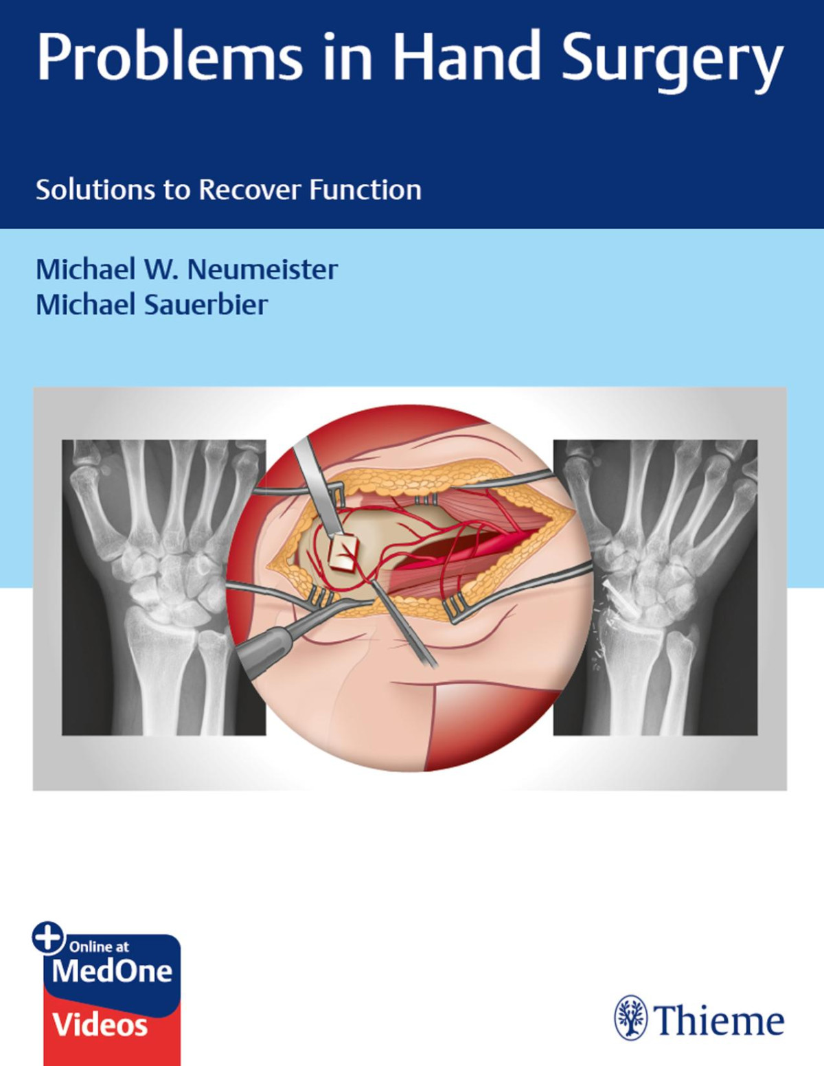 Problems In Hand Surgery Solutions To Recover Function Michael W Neumeister