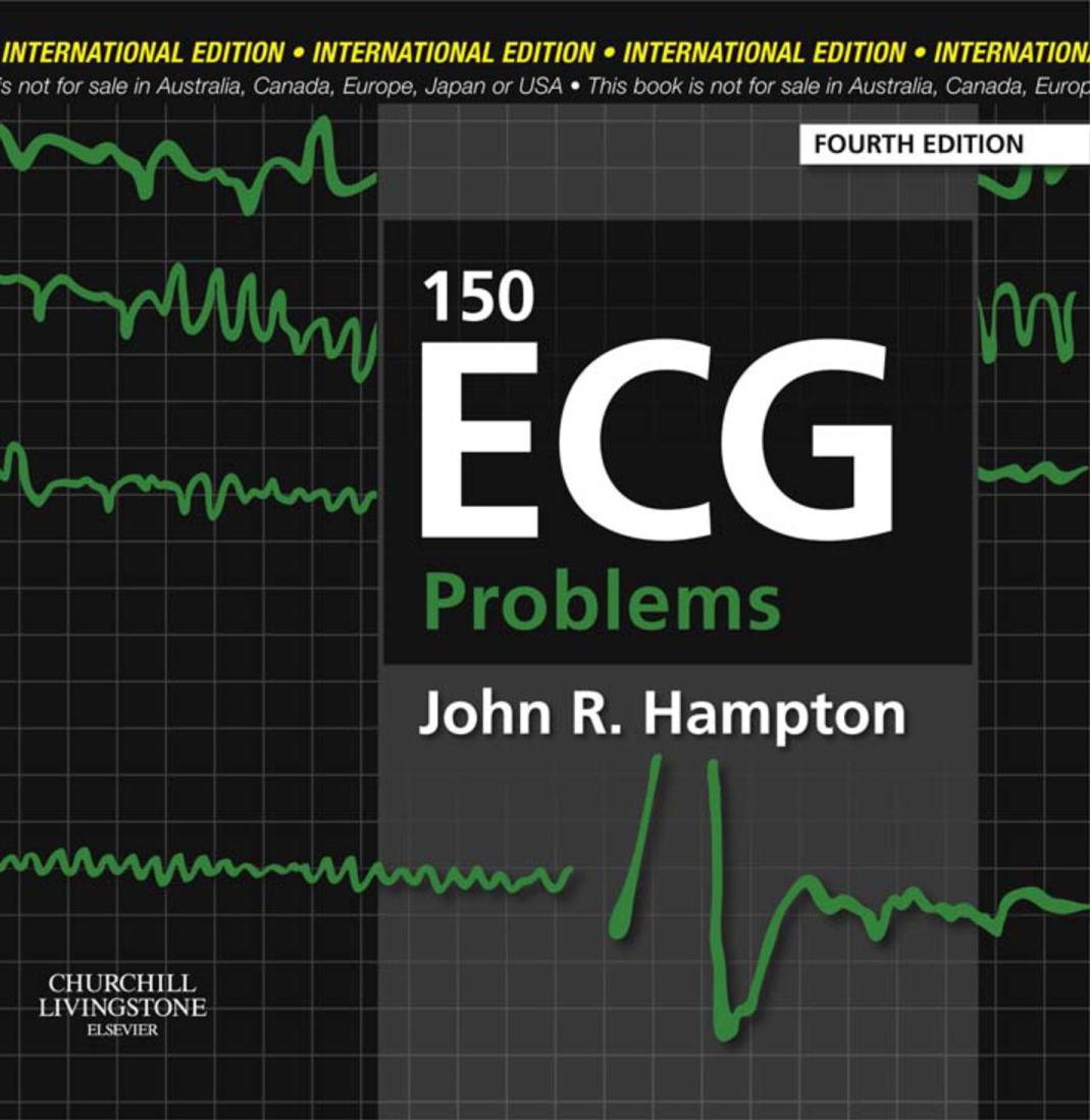 150 Ecg Problems 4th Edition John R Hampton
