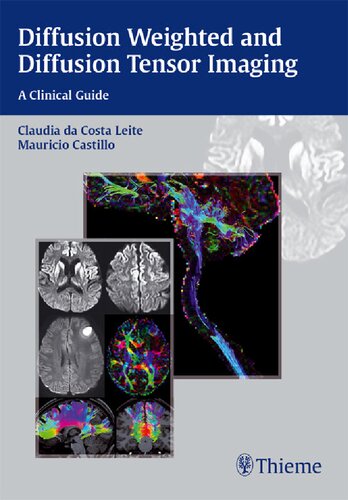 Diffusion Weighted And Diffusion Tensor Imaging A Clinical Guide Claudia Da Costa Leite