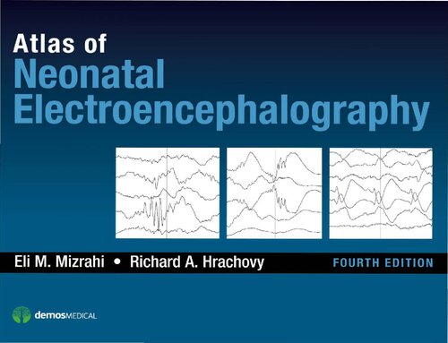 Atlas Of Neonatal Electroencephalography 4th Edition Eli M Mizrahi