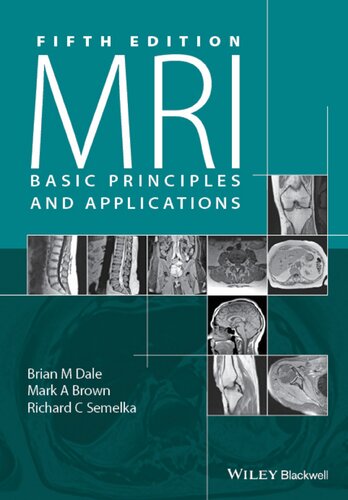 Mri Basic Principles And Applications 5th Edition Brian M Dale