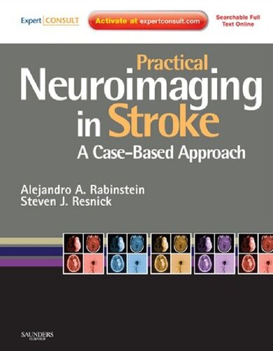 Practical Neuroimaging In Stroke A Casebased Approach Alejandro A Rabinstein