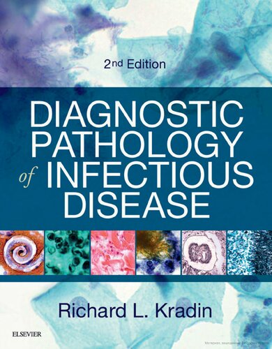 Diagnostic Pathology Of Infectious Disease 2nd Edition Richard L Kradin