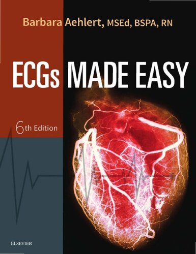 Ecgs Made Easy 6th Edition Aehlert Barbara