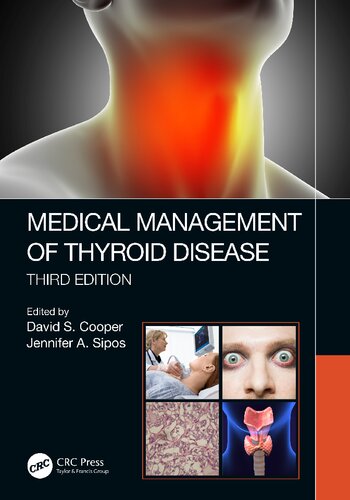 Medical Management Of Thyroiddisease 3rd Edition David S Cooper
