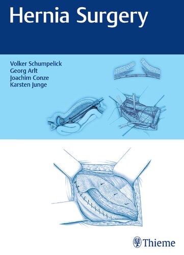 Hernia Surgery Volker Schumpelick Georg Arlt Joachim Conze Karsten Junge