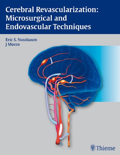 Cerebral Revascularization Eric S Nussbaum J Mocco