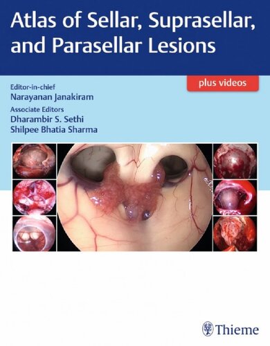 Atlas Of Sellar Suprasellar And Parasellar Lesions Narayanan Janakiram