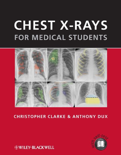 Chest Xrays For Medical Students Christopher Clarke Anthony Dux