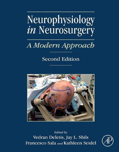 Neurophysiology In Neurosurgery 2nd Edition Vedran Deletis Jay L Shils
