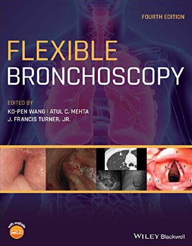 Flexible Bronchoscopy 4th Edition Kopen Wang Atul C Mehta J Francis Turner