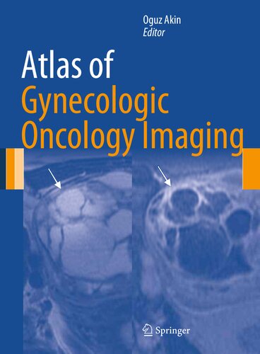 Atlas Of Gynecologic Oncology Imaging Oguz Akin Editor