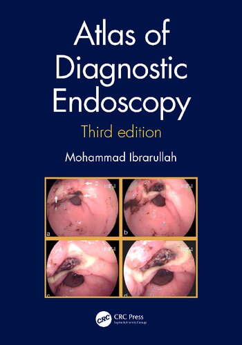 Atlas Of Diagnostic Endoscopy 3rd Edition Mohammad Ibrarullah