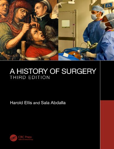 A History Of Surgery 3rd Edition Sala Abdalla Harold Ellis