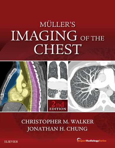 Mullers Imaging Of The Chest Ebook Expert Radiology Series 2nd Edition Christopher Walker Jonathan Hero Chung