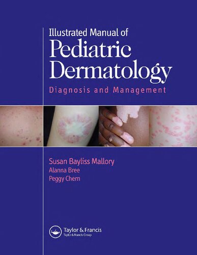 Handbook Of Pediatric Dermatology Susan Bayliss Mallory