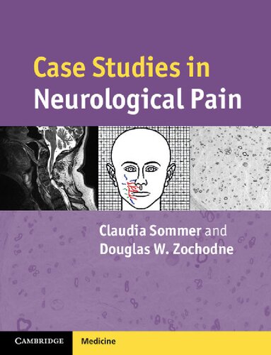 Case Studies In Neurological Pain Claudia Sommer Douglas W Zochodne