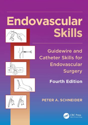 Endovascular Skills Guidewire And Catheter Skills For Endovascular Surgery 4th Edition Peter A Schneider