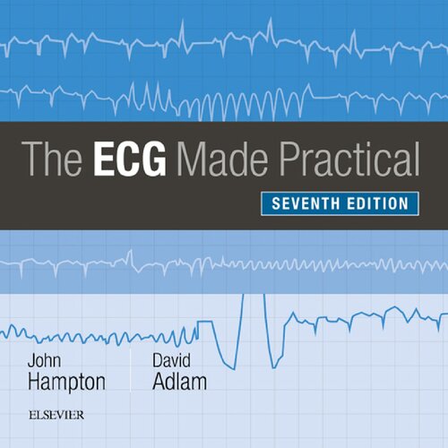 The Ecg Made Practical John R Hampton