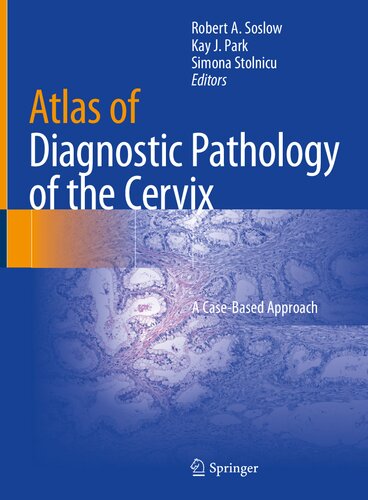Atlas Of Diagnostic Pathology Of The Cervix A Casebased Approach 1st Robert A Soslow Editor