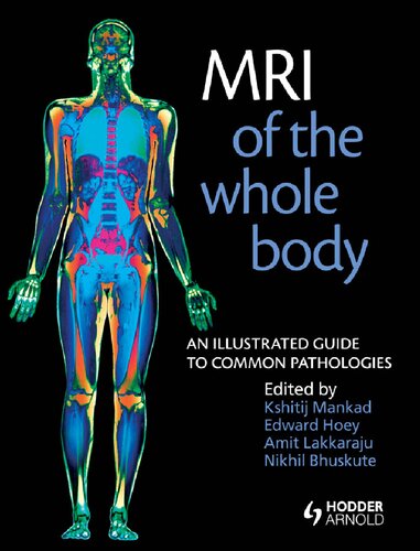 Mri Of The Whole Body An Illustrated Guide To Common Pathologies Mankad Kshitij Ed Hoey Edward Td Ed Lakkaraju Amited Bhuskutenikhil Ed