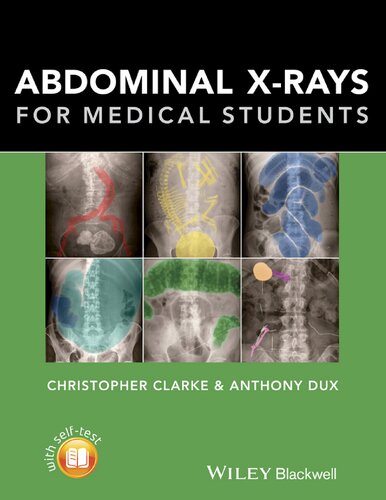 Abdominal Xrays For Medical Students Christopher Clarke Anthony Dux