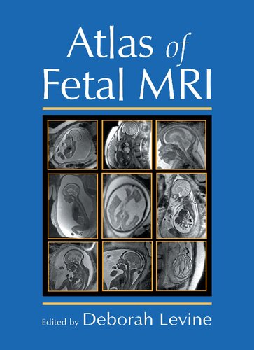 Atlas Of Fetal Mri Deborah Levine