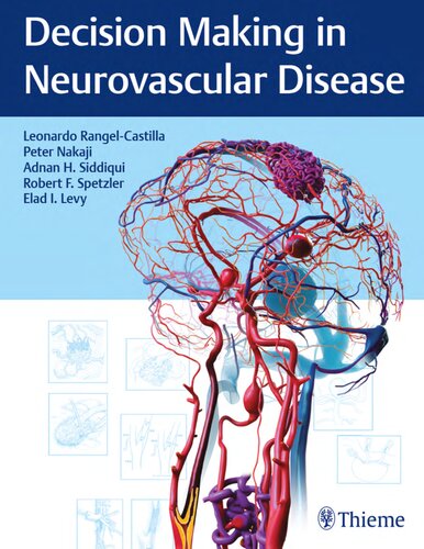 Decision Making In Neurovascular Disease Peter Nakaji