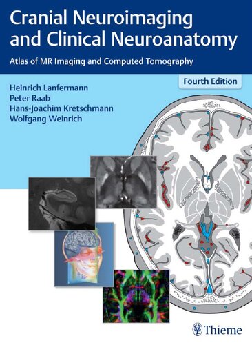 Cranial Neuroimaging And Clinical Neuroanatomy Atlas Of Mr Imaging And Computed Tomography 4th Edition Heinrich Lanfermann