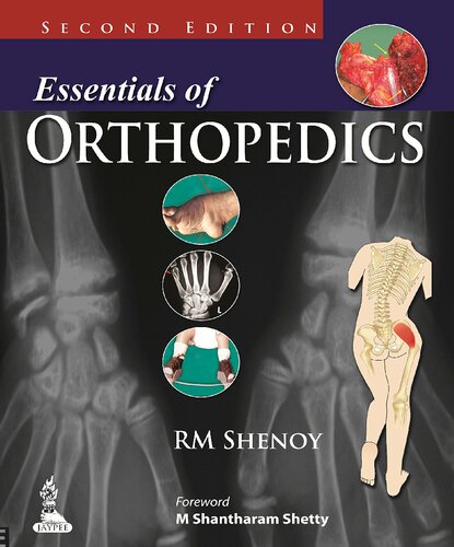 Essentials Of Orthopedics 2nd Edition Shenoy Rm