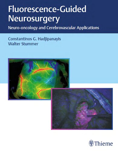 Fluorescenceguided Neurosurgery Neurooncology And Cerebrovascular Applications 1st Constantinos G Hadjipanayis Walter Stummer